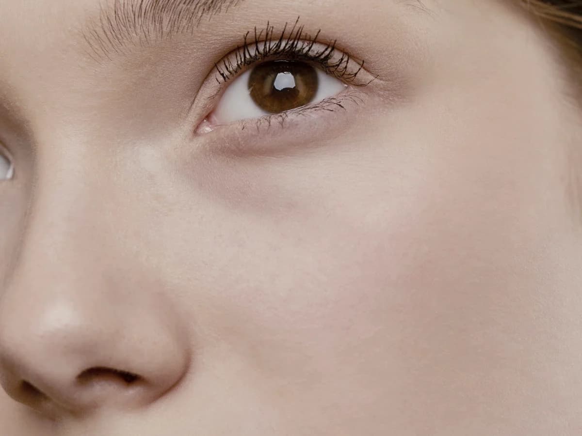 Close-up of dull, uneven skin before treatment — illustrative. TODO: replace with consented client photo