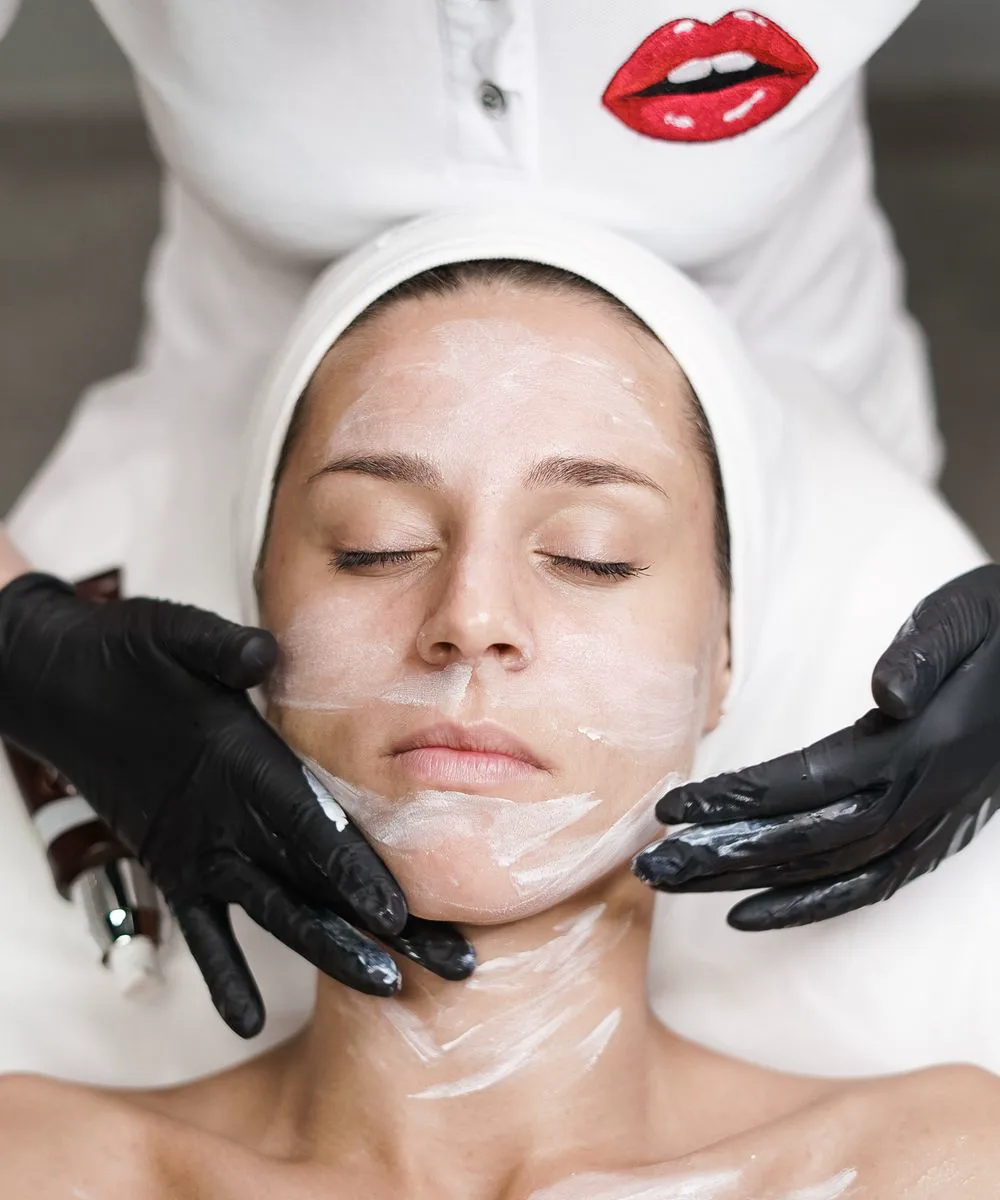 Chemical peel applied during a skin-resurfacing treatment at Voila, Wapda Town, Lahore