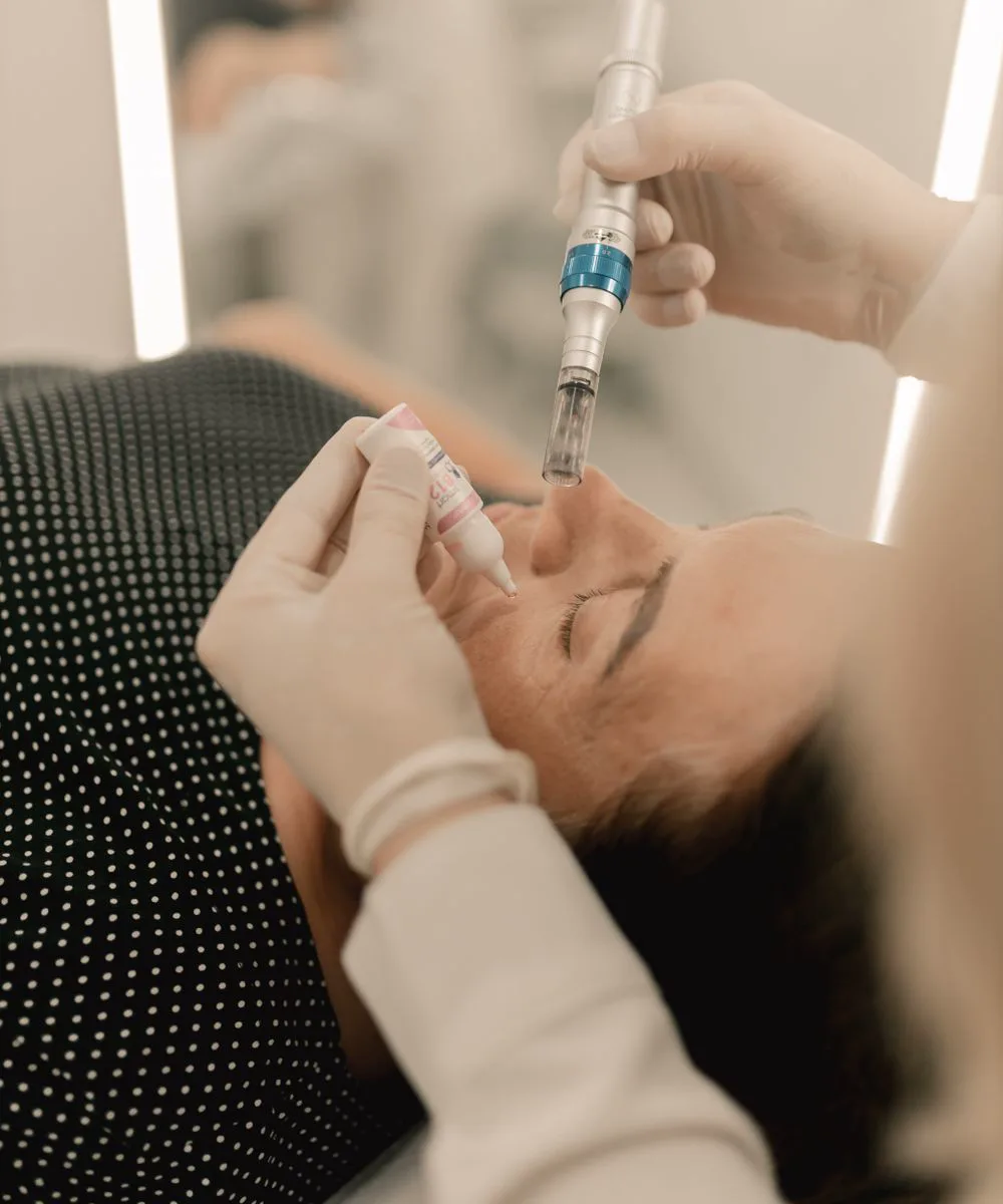 Microneedling pen with serum applied to a client's face at Voila, Wapda Town, Lahore